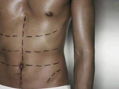 Male body